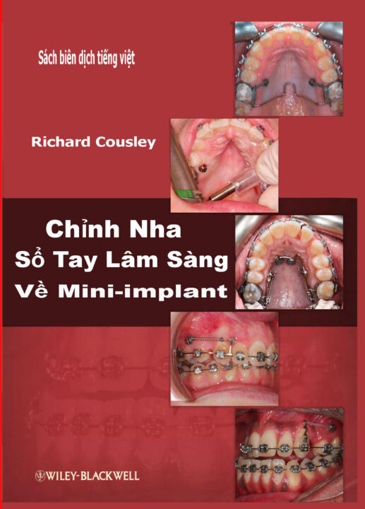 Chỉnh nha Sổ tay lâm sàng về Mini-implant