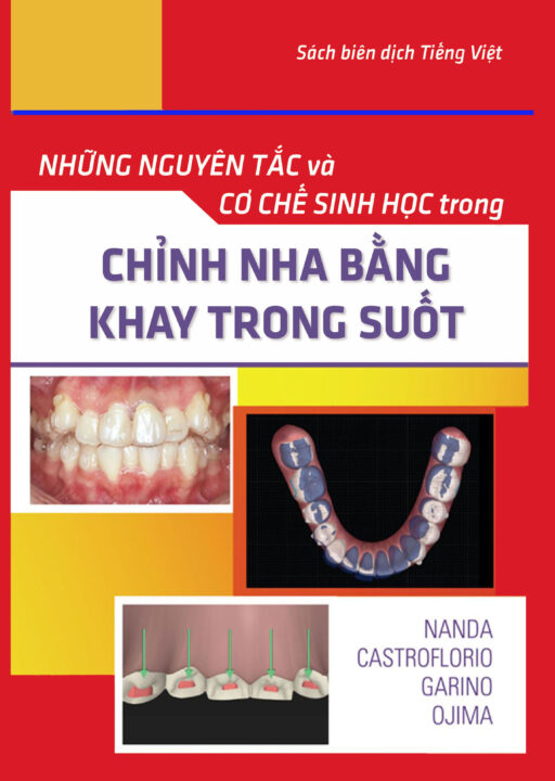 Sách Chỉnh Nha Bằng Khay Trong Suốt 2023 (sách dịch bản tiếng việt )